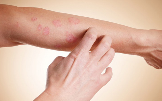 Dermatologia Clínica