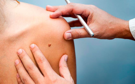 Dermatologia Cirúrgica